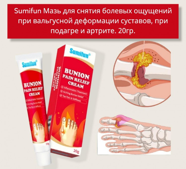 SUMIFUN Мазь для снятия болевых ощущений при вальгусной деформации суставов